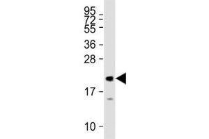 MML2 antibody tested on human recombinant protein at 1:27000. (MLL2 anticorps  (AA 4980-5009))