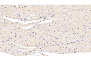 Detection of LEP in Mouse Cardiac Muscle Tissue using Polyclonal Antibody to Leptin (LEP) (Leptin anticorps  (AA 22-167))