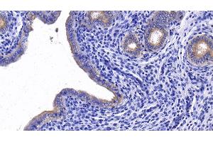 Detection of DDX58 in Rat Uterus Tissue using Polyclonal Antibody to Probable ATP-dependent RNA Helicase DDX58 (DDX58) (DDX58 anticorps  (AA 550-776))