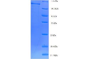 SDS-PAGE (SDS) image for Sorting Nexin 1 (SNX1) (AA 1-522), (full length) protein (His-SUMO Tag) (ABIN5711327)