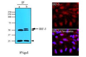 Western Blotting (WB) image for anti-Interferon Regulatory Factor 3 (IRF3) (AA 108-166) antibody (ABIN317099) (IRF3 anticorps  (AA 108-166))