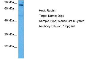 Host: Rabbit Target Name: DLG4 Sample Tissue: Mouse Brain Antibody Dilution: 1ug/ml (DLG4 anticorps  (Middle Region))