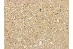 MBNL2 Mouse Monoclonal Antibody at 1/100 staining human normal liver tissue by IHC-P. (MBNL2 anticorps)