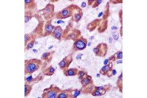 Immunohistochemistry (IHC) image for anti-Nuclear Receptor Subfamily 0, Group B, Member 2 (NR0B2) antibody (ABIN7308092)