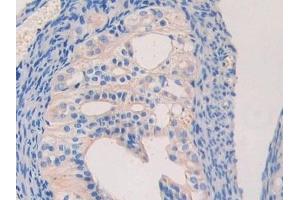 Detection of LAMb2 in Mouse Oviduct Tissue using Polyclonal Antibody to Laminin Beta 2 (LAMb2)