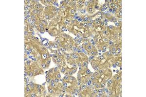 Immunohistochemistry of paraffin-embedded rat kidney using PSMD5 antibody (ABIN5975452) at dilution of 1/100 (40x lens).