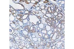IHC analysis of Cytokeratin 8/KRT8 using anti-Cytokeratin 8/KRT8 antibody (ABIN5518853).