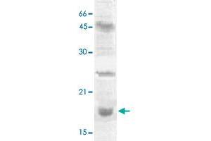 The nuclear extract derived from NIH/3T3 were immunoprecipitated by 4 ug of HIST2H3C polyclonal antibody , then probed with HIST2H3C polyclonal antibody  at 1 : 1000. (Histone Cluster 2, H3c (HIST2H3C) (Lys27) anticorps)