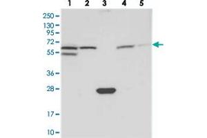 Western blot analysis of Lane 1: RT-4, Lane 2: U-251 MG, Lane 3: Human Plasma, Lane 4: Liver, Lane 5: Tonsil with SPATA18 polyclonal antibody . (SPATA18 anticorps)