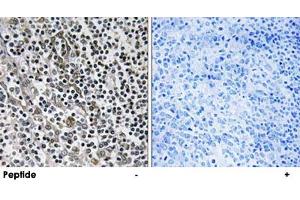 Immunohistochemistry analysis of paraffin-embedded human tonsil tissue using MRPL51 polyclonal antibody . (MRPL51 anticorps)