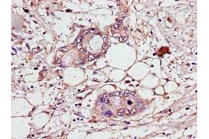 anti-Centrosomal Protein 70kDa (CEP70) (AA 99-276) antibody