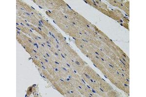 Immunohistochemistry of paraffin-embedded Rat heart using ALDH9A1 Polyclonal Antibody (ALDH9A1 anticorps)