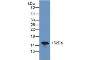 Detection of GAL7 in Rat Skin Tissue using Polyclonal Antibody to Galectin 7 (GAL7) (LGALS7 anticorps  (AA 1-136))