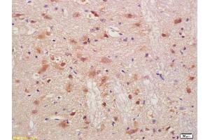 Formalin-fixed and paraffin embedded rat brain labeled with Anti-PMP2 Polyclonal Antibody, Unconjugated (ABIN676823) at 1:200, followed by conjugation to the secondary antibody and DAB staining (PMP2 anticorps  (AA 31-132))