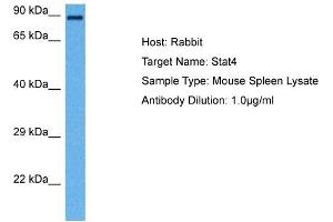 Host: Rabbit Target Name: STAT4 Sample Tissue: Mouse Spleen Antibody Dilution: 1ug/ml (STAT4 anticorps  (N-Term))