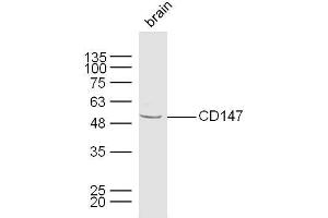 Mouse brain lysates probed with CD147 Polyclonal Antibody, unconjugated  at 1:300 overnight at 4°C followed by a conjugated secondary antibody at 1:10000 for 60 minutes at 37°C. (CD147 anticorps  (AA 301-385))