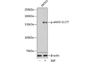 Western blot analysis of extracts of SKOV3 cells using Phospho-eNOS(S1177) Polyclonal Antibody. (ENOS anticorps  (pSer1177))
