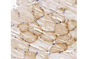 Immunohistochemistry analysis of paraffin-embedded rat muscle using,PPAPDC3 (ABIN7075036) at dilution of 1: 4000