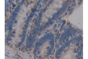 Detection of ICAM2 in Rat Small intestine Tissue using Polyclonal Antibody to Intercellular Adhesion Molecule 2 (ICAM2) (ICAM2 anticorps  (AA 29-247))