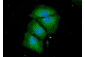 ICC/IF analysis of ACSF2 in HeLa cells line, stained with DAPI (Blue) for nucleus staining and monoclonal anti-human ACSF2 antibody (1:100) with goat anti-mouse IgG-Alexa fluor 488 conjugate (Green) (ACSF2 anticorps)