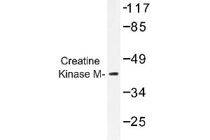 Image no. 1 for anti-Creatine Kinase, Muscle (CKM) antibody (ABIN272157) (CKM anticorps)