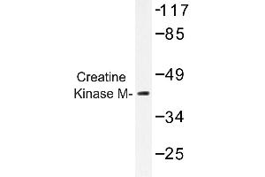 Image no. 1 for anti-Creatine Kinase, Muscle (CKM) antibody (ABIN272157)