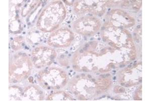 IHC-P analysis of Human Kidney Tissue, with DAB staining. (TPMT anticorps  (AA 26-227))