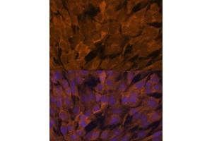 Immunofluorescence analysis of C6 cells using ST antibody (ABIN6129464, ABIN6148550, ABIN6148551 and ABIN6222848) at dilution of 1:100.