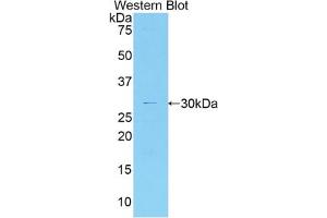 Western blot analysis of the recombinant protein. (MYO1G anticorps  (AA 769-1016))