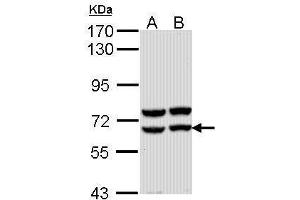 WB Image Sample (30 ug of whole cell lysate) A: Molt-4 , B: Raji 7. (AMY2A anticorps)