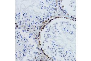 Immunohistochemistry of paraffin-embedded mouse testis using Acetyl-Histone H2B-K12 antibody (ABIN7267731) at dilution of 1:200 (40x lens).