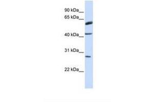 Image no. 1 for anti-Ring Finger Protein 170 (RNF170) (AA 110-159) antibody (ABIN6738072) (RNF170 anticorps  (AA 110-159))