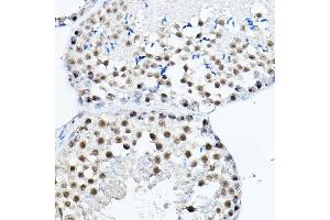 Immunohistochemistry of paraffin-embedded mouse testis using MDC1 Rabbit pAb (ABIN6134688, ABIN6143659, ABIN6143661 and ABIN6216452) at dilution of 1:150 (40x lens).