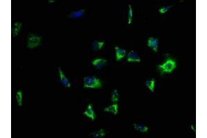 Immunofluorescence staining of SH-SY5Y cells with ABIN7158138 at 1:133, counter-stained with DAPI. (LRRC15 anticorps  (AA 301-538))