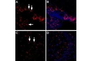 Expression of LPA4 receptor in rat and mouse brain - Immunohistochemical staining of rat choroid plexus and mouse hippocampal CA3 region using Anti-LPAR4 (P2Y9) (extracellular) Antibody (ABIN7043315, ABIN7044572 and ABIN7044573), (1:400).