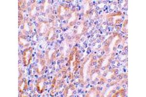 Immunohistochemistry of Dffb in mouse kidney tissue with Dffb polyclonal antibody  at 1 ug/mL . (DFFB anticorps  (AA 314-329))