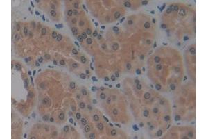 IHC-P analysis of Human Kidney Tissue, with DAB staining. (MMP14 anticorps  (AA 112-321))