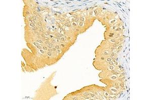 Immunohistochemistry of paraffin embedded rat bladder using CEACAM1 (ABIN7073315) at dilution of 1: 650 (400x lens)
