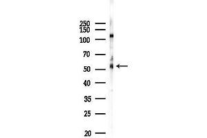 anti-Somatostatin Receptor 3 (SSTR3) (C-Term) antibody