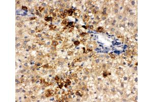 Anti-HNF6 antibody, IHC(P) IHC(P): Rat Liver Tissue (ONECUT1 anticorps  (N-Term))
