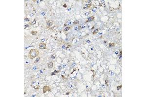 Immunohistochemistry of paraffin-embedded rat brain using BCS1L antibody.