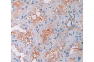 Used in DAB staining on fromalin fixed paraffin- embedded kidney tissue (Amyloid beta Precursor Protein Binding Protein 1 (AA 229-534) anticorps)
