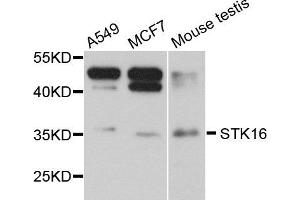 Western blot analysis of extract of various cells, using STK16 antibody. (STK16 anticorps)