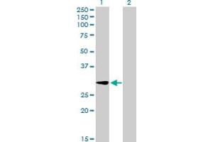 Western Blot analysis of GALNT12 expression in transfected 293T cell line by GALNT12 MaxPab polyclonal antibody. (GALNT12 anticorps  (AA 1-272))