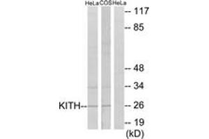 Western Blotting (WB) image for anti-Thymidine Kinase 1, Soluble (TK1) (AA 161-210) antibody (ABIN2889377) (TK1 anticorps  (AA 161-210))