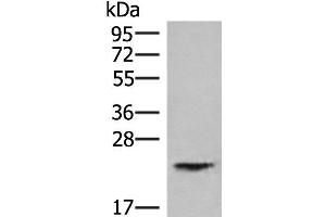 Western blot analysis of Human kidney tissue lysate using HEBP1 Polyclonal Antibody at dilution of 1:750 (HEBP1 anticorps)