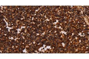 Immunohistochemistry of paraffin-embedded Human tonsil tissue using ALG11 Polyclonal Antibody at dilution 1:40