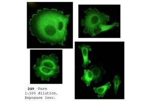 Immunofluorescence (IF) image for anti-Neural Precursor Cell Expressed, Developmentally Down-Regulated 9 (NEDD9) (AA 82-398) antibody (ABIN7278755) (NEDD9 anticorps  (AA 82-398))