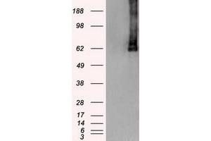 HEK293T cells were transfected with the pCMV6-ENTRY control (Left lane) or pCMV6-ENTRY PLK1 (Right lane) cDNA for 48 hrs and lysed. (PLK1 anticorps)