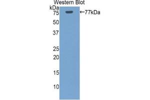 Detection of Recombinant HSPA1L, Human using Polyclonal Antibody to Heat Shock 70 kDa Protein 1 Like Protein (HSPA1L)